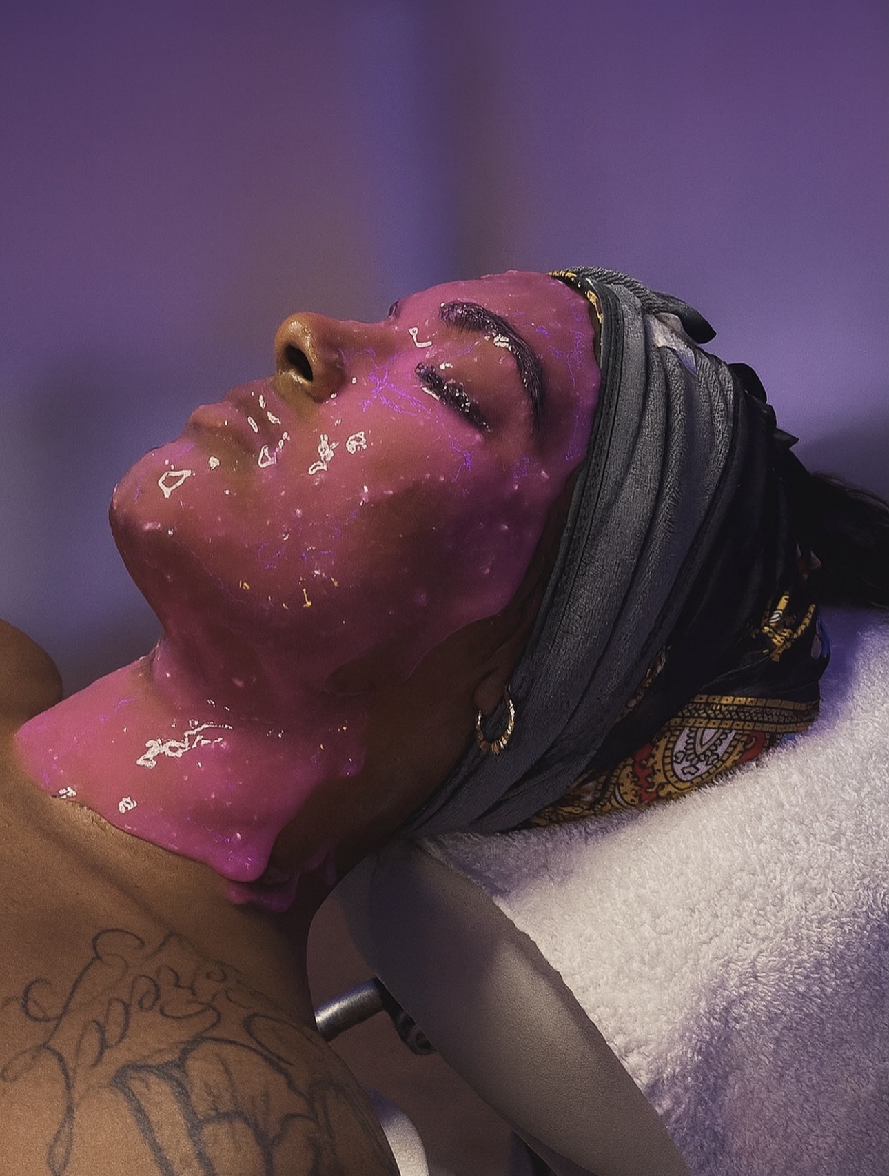 Enhanced Aesthetics treatment result