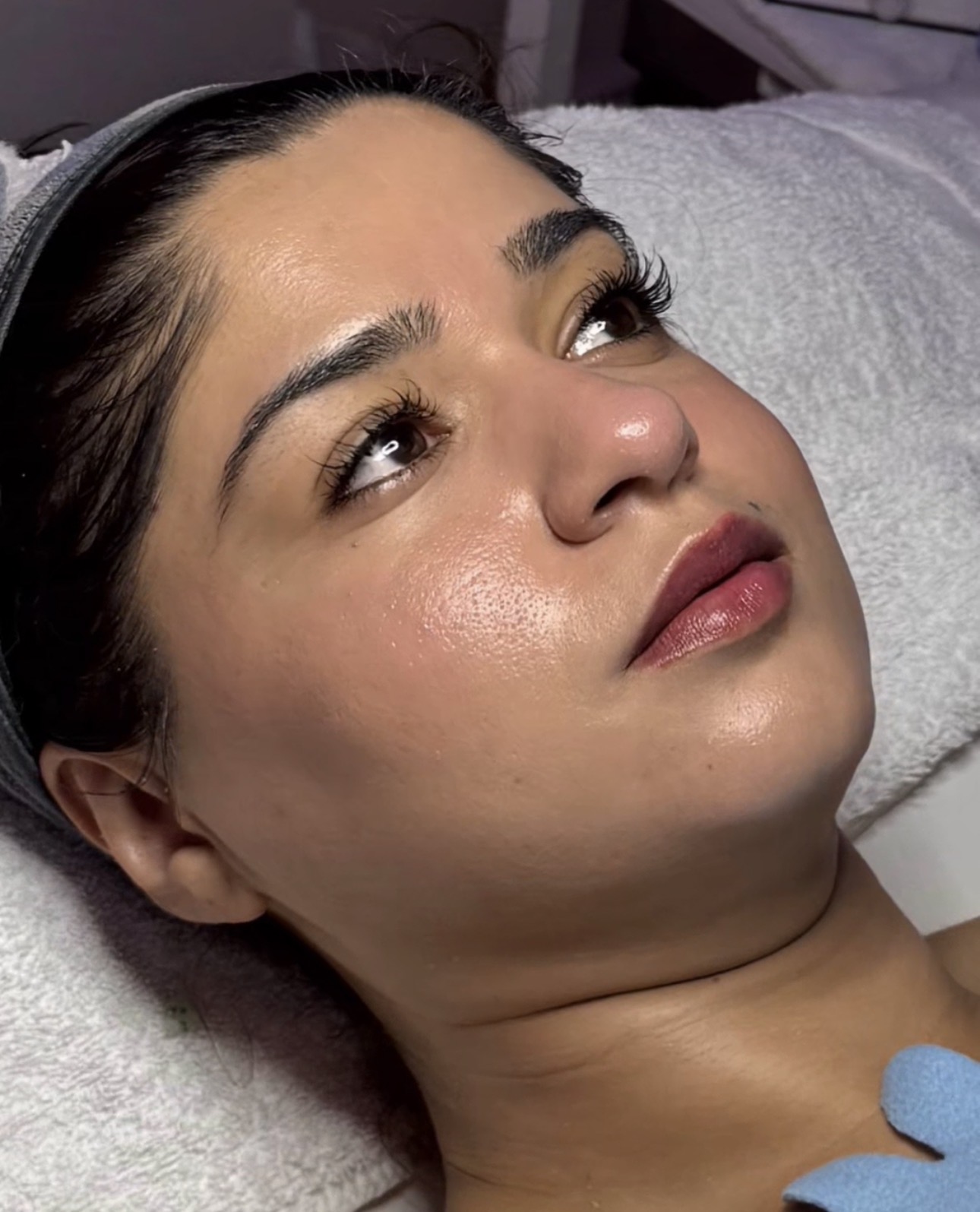 Enhanced Aesthetics treatment result