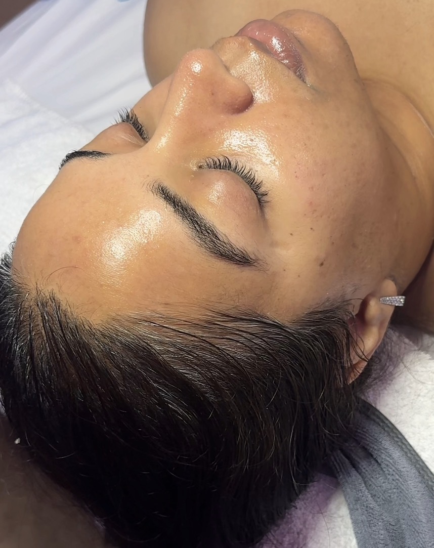 Enhanced Aesthetics treatment result