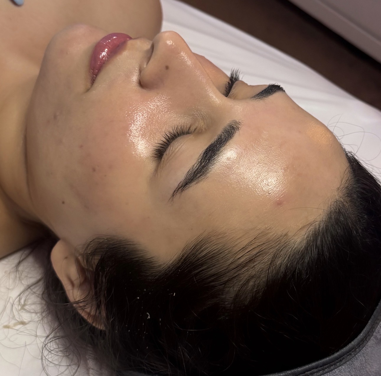 Enhanced Aesthetics treatment result